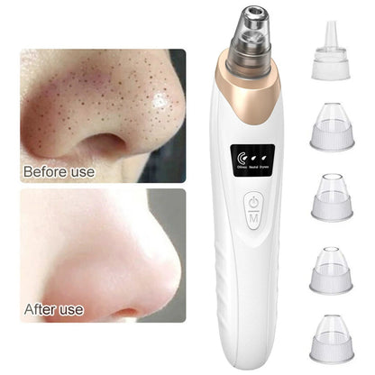 Blackhead Remover & Pore Vacuum (USB Rechargeable)